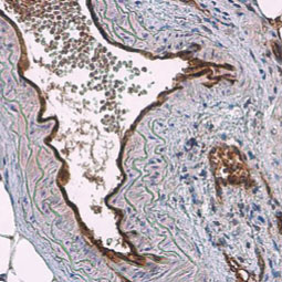 CD31 antibody (GTX130274)