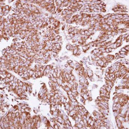 Angiopoietin 2 antibody (GTX100928)