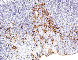 CTLA4 antibody(GTX57204)