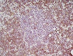CD4 antibody(GTX44531)