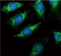 Pyruvate Dehydrogenase E1 alpha antibody