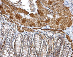 alpha Smooth Muscle Actin antibody