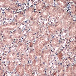 Von Hippel Lindau antibody