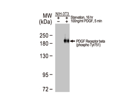 PDGF Receptor beta (phospho Tyr751) antibody