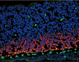 Vimentin antibody [GT812] (GTX629744)