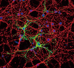 Glutamine synthetase antibody 