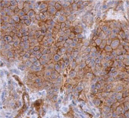 CD146 antibody(GTX108777)