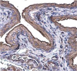 Cytokeratin 20 antibody(GTX110600)