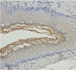 Filaggrin antibody(GTX37695)