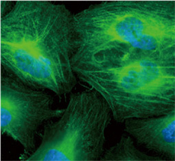alpha Smooth Muscle Actin antibody [GT445] GTX629702