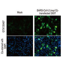 TMPRSS2 antibody [N2C3] (GTX100743)