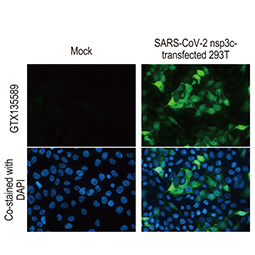 ACE2 antibody [N1N2], N-term (GTX101395)