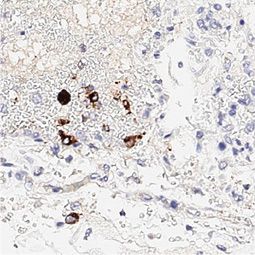 SARS-CoV-2 (COVID-19) Spike S1 antibody [HL6]
