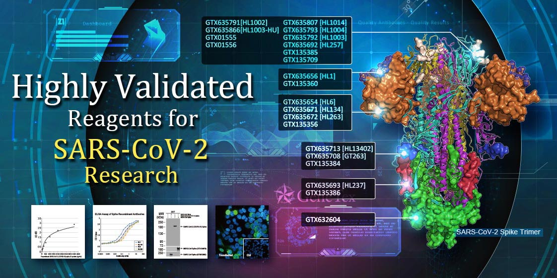 SARS-CoV-2 (COVID-19) antibodies