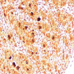 Enterovirus 71 2B antibody (GTX132343)