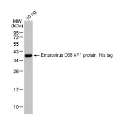 Enterovirus D68 VP1 protein, His tag (GTX138561-pro)