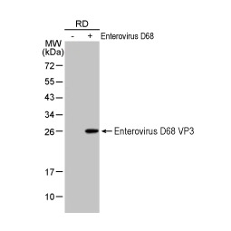 Enterovirus D68 VP3 antibody [HL3202]