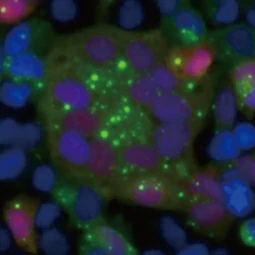 Respiratory Syncytial Virus Nucleoprotein antibody [HL1248] (GTX636650)