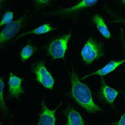 Calreticulin antibody
