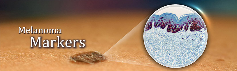 Melanoma Markers
