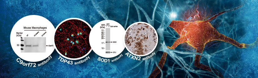 Amyotrophic Lateral Sclerosis