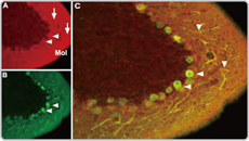 Cav1.2 antibody (GTX54754)