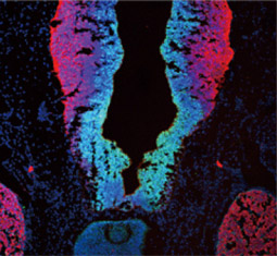 SOX2 antibody (GTX101507)