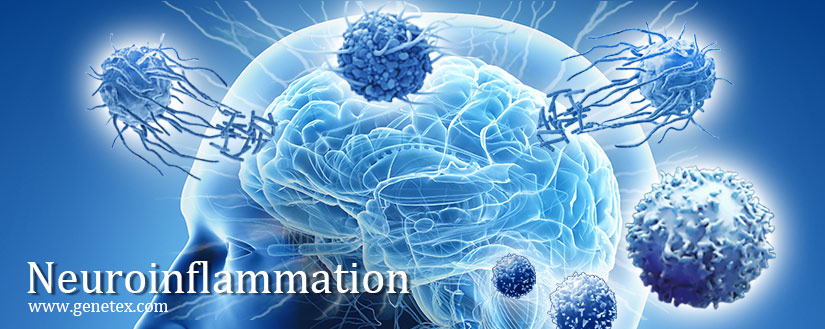 Neuroinflammation