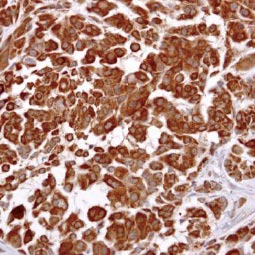 LHR antibody [C3], C-term (GTX100008)