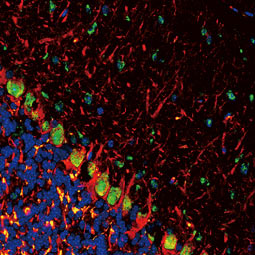 Somatostatin antibody (GTX133119)