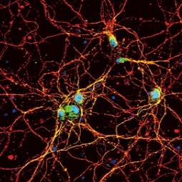 Somatostatin receptor 3 antibody (GTX130114)