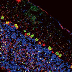 Calcitonin antibody(GTX134005)