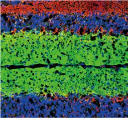 EAAT1 antibody GTX134059