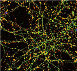 Serotonin Transporter antibody GTX133101