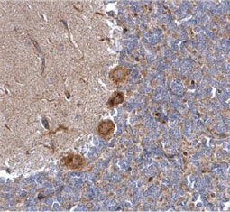 (GTX17570)alpha 1a Adrenergic Receptor antibody GTX100190