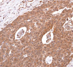 beta 2 Adrenergic Receptor antibody [C2C3], C-term GTX100040
