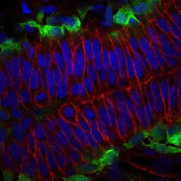 Zebrafish-antibodies-Cdh2 (N-cadherin)