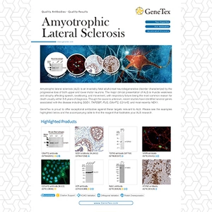 Amyotrophic Lateral Sclerosis
