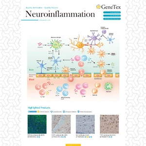 Neuroinflammation