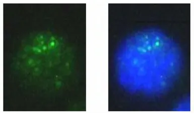 Anti-MITF antibody used in Immunocytochemistry/ Immunofluorescence (ICC/IF). GTX00738