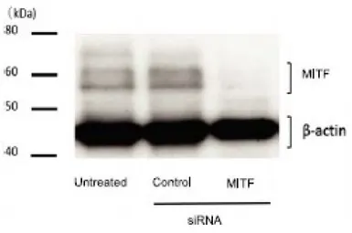 Anti-MITF antibody used in Western Blot (WB). GTX00738