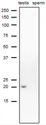 Anti-CD52 antibody used in Western Blot (WB). GTX00743