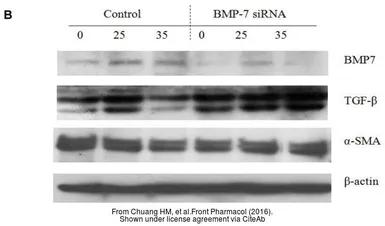 Anti-alpha Smooth Muscle Actin antibody used in Western Blot (WB). GTX100034