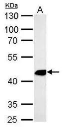 Anti-alpha Smooth Muscle Actin antibody used in Western Blot (WB). GTX100034