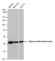 Anti-alpha Smooth Muscle Actin antibody used in Western Blot (WB). GTX100034