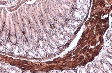 Anti-alpha Smooth Muscle Actin antibody used in IHC (Paraffin sections) (IHC-P). GTX100034