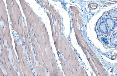 Anti-alpha Smooth Muscle Actin antibody used in IHC (Paraffin sections) (IHC-P). GTX100034