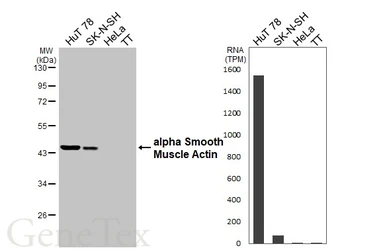 Anti-alpha Smooth Muscle Actin antibody used in Western Blot (WB). GTX100034