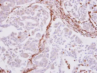 Anti-alpha Smooth Muscle Actin antibody used in IHC (Paraffin sections) (IHC-P). GTX100034