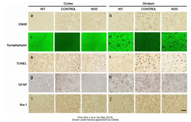 Anti-Iba1 antibody used in  (). GTX100042